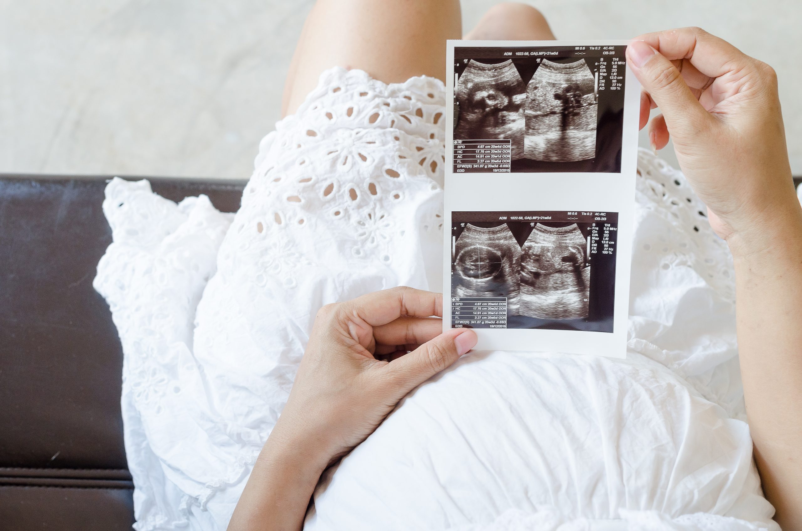 Kobieta w ciąży trzyma w ręku zdjęcie z badania USG
