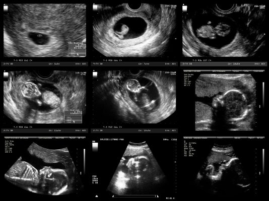 Badania prenatalne w ciąży – wszystko, co musisz wiedzieć