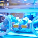 Żółtaczka u noworodka – co należy o niej wiedzieć?