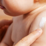 Atopowe zapalenie skóry u niemowląt – objawy i leczenie