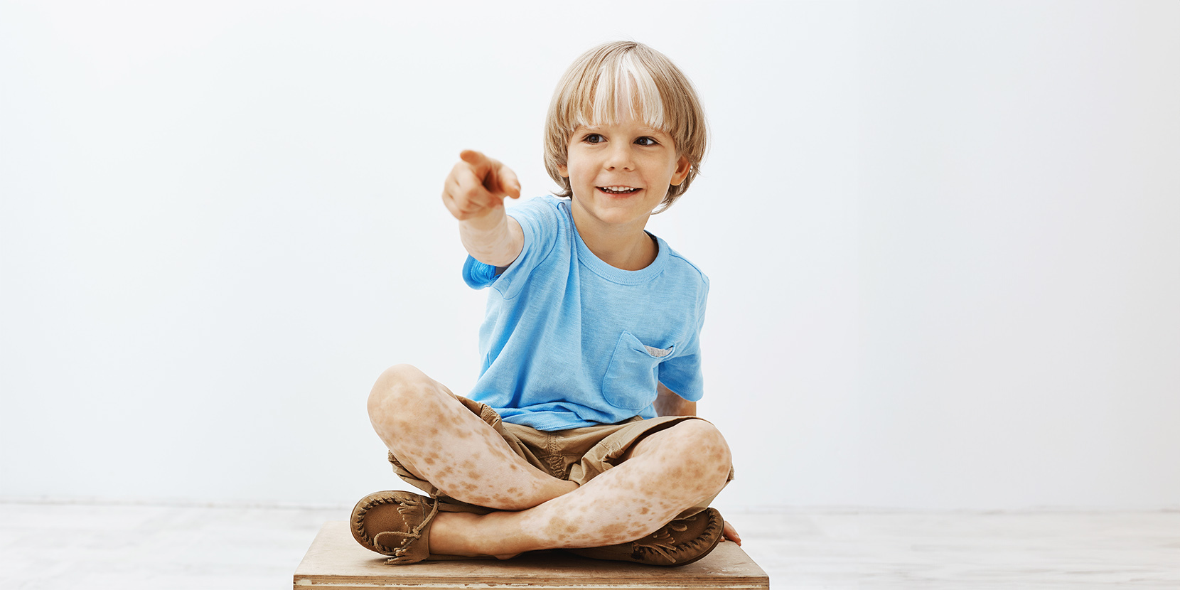 Chłopiec z bielactwem siedzi na podłodze /fot. Adobe Stock